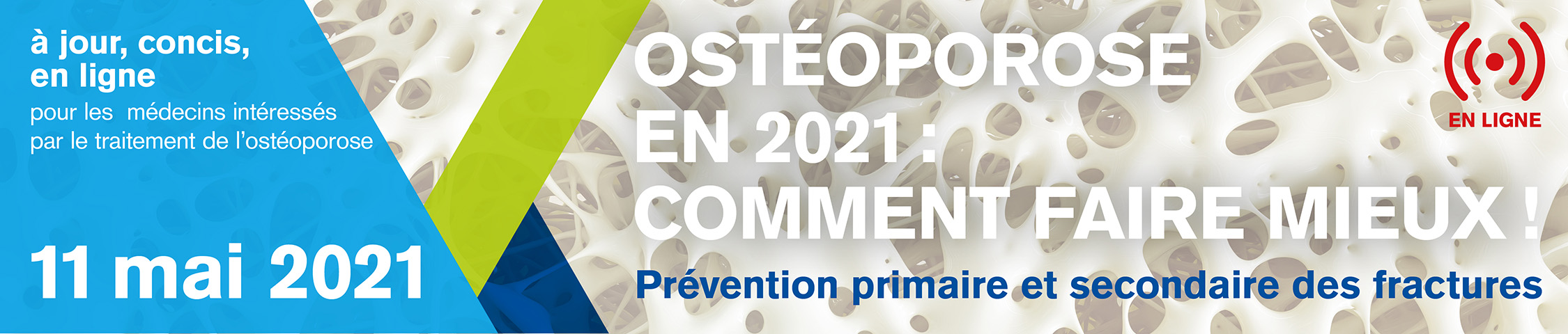 OSTÉOPOROSE EN 2021 : COMMENT FAIRE MIEUX !